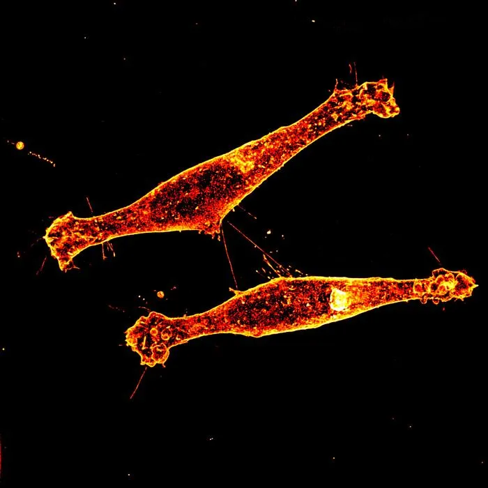 Tunneling Nanotubes
