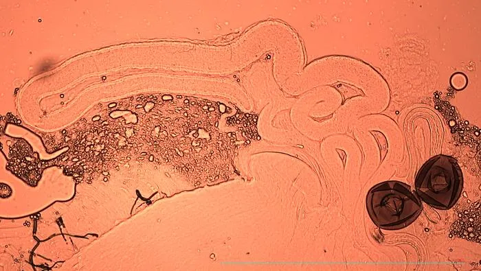 Sperm in the spermathecae