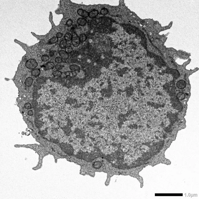 MLKL-Dependent Mitochondrial Changes in Aged Hematopoietic Stem Cells