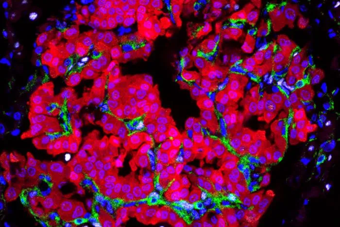 Tumor Cells Transform Their Local Environment