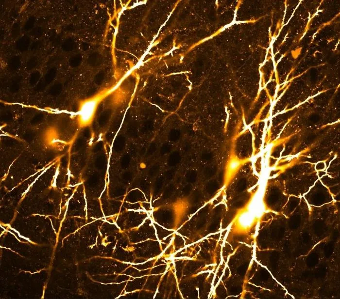 Network of interconnected CA3 pyramidal neurons (young mice)