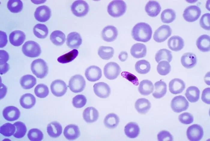 Study reveals an immune evasion strategy used by Plasmodium