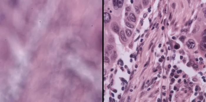Simple New System Keeps Microscopes in Focus Automatically