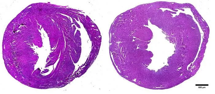 Advancing new heart failure therapies