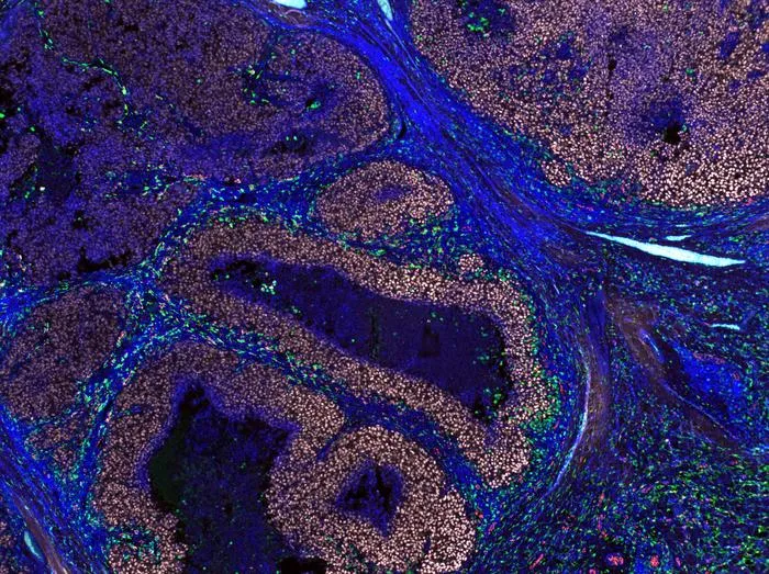 Imaging of human melanoma biopsy
