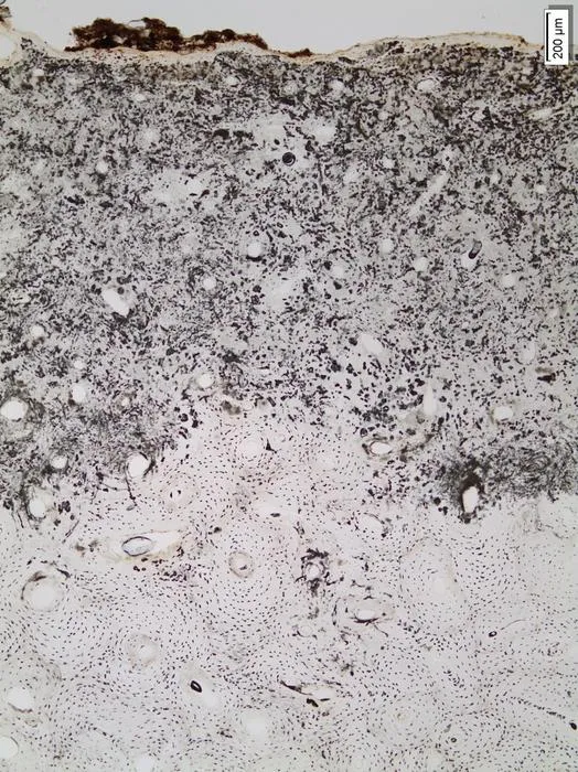 Histological and metagenomic analysis of microbial communities in archaeological human bones