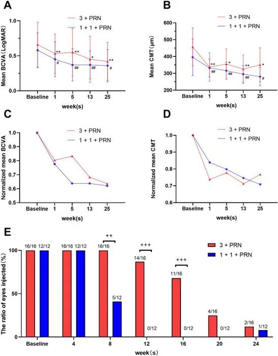 The comparison between “1 + 1 + PRN” regimen and “3 + PRN” regimen in treatment-naïve DME.