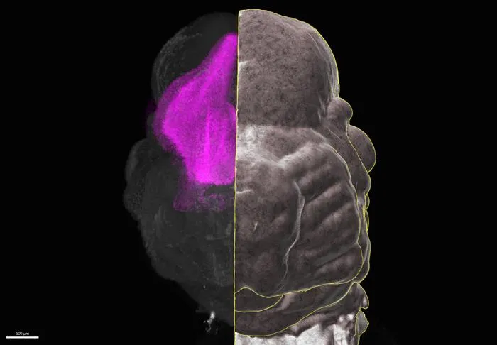 mouse embryo's head in the early stages of development