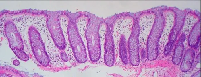 Colonic biopsy samples