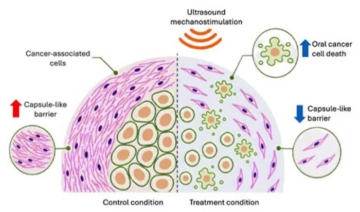 Ultrasound mechanostimulation-mediated killing of oral cancer cells and compromised integrity of the capsule-like barrier