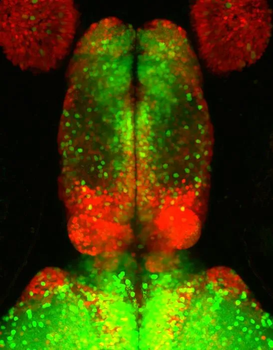 Zebrafish Forebrain