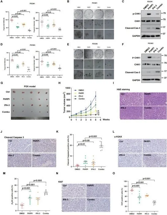 Combination of IPA-3 and olaparib synergistically suppresses ovarian cancer cells' growth in patient-derived organoid and patient-derived xenograft models