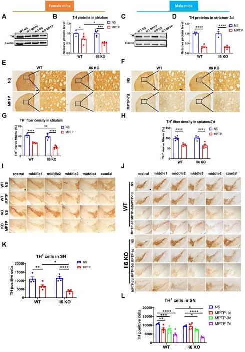 Alterations of the Nigrostriatal Dopaminergic System after Parkinson’s Disease Modeling in Il6 Knockout (KO) and Wild-Type (WT) Mice of both Sexes