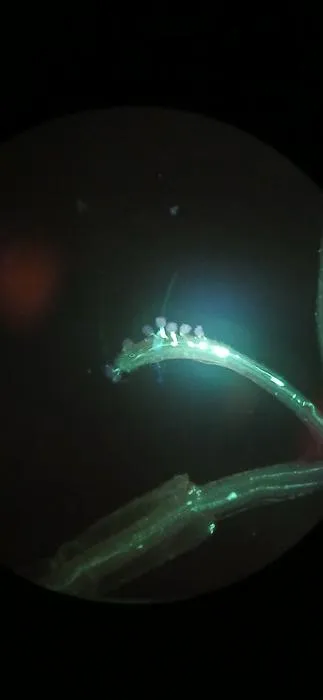 Aniline staining microscopy