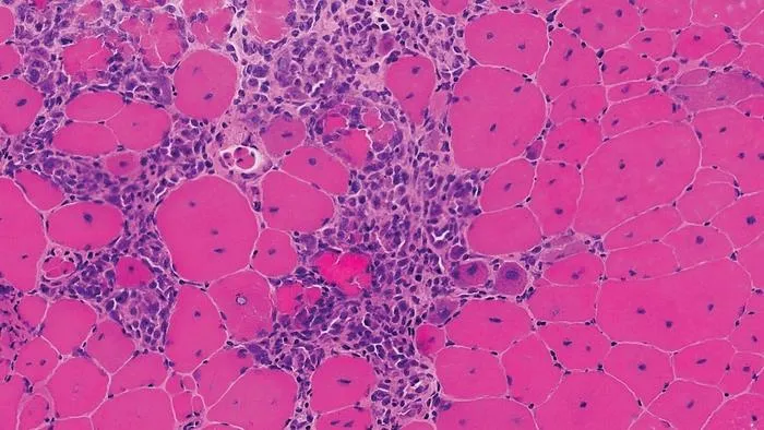 Muscle tissue