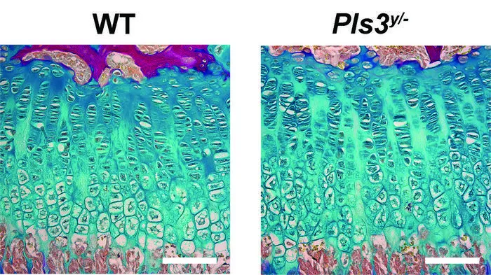 Epiphyseal plate microscopy image