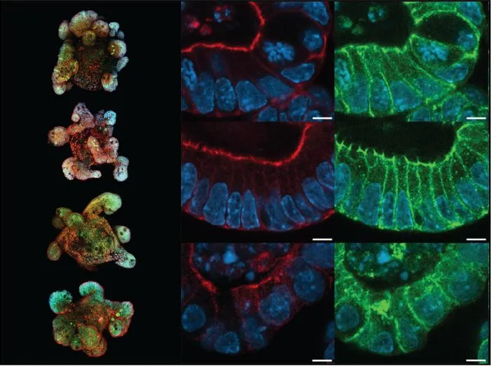 Mapping key proteins on gut organoids