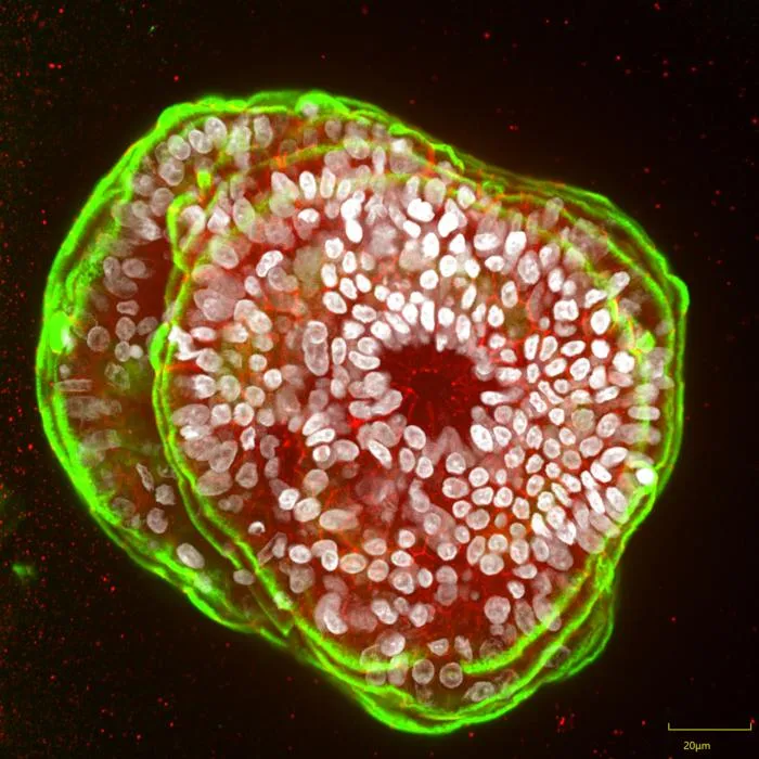 Healthy pancreas organoids