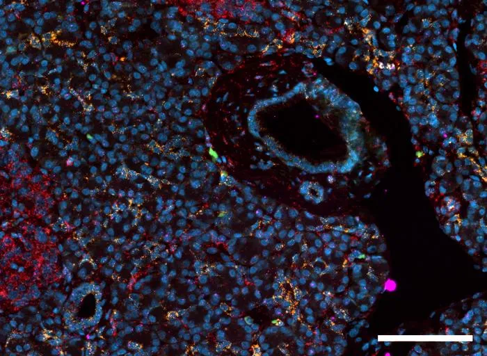 Human pancreas tissue