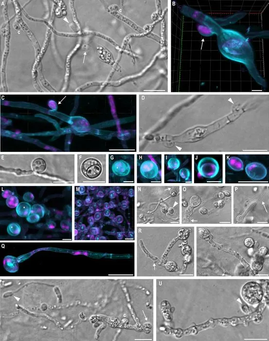 Structures that are likely to play a role in the fungal life cycle