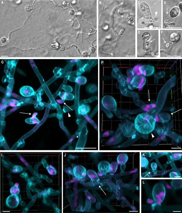 The considerable diversity of the basidium-like cells