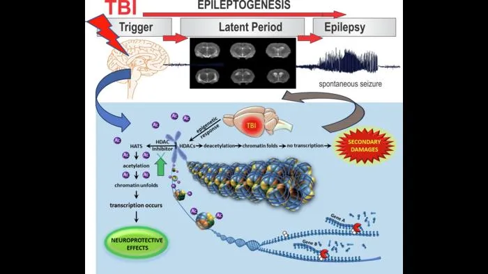 Scientists tame seizures and heal injured brains with gut chemical