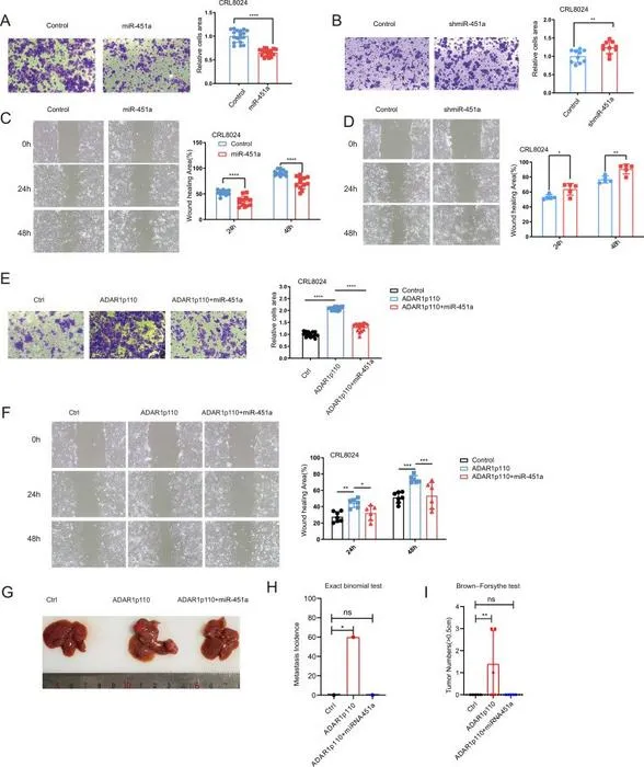 miR-451a abolishes ADAR1p110-mediated HCC metastasis.