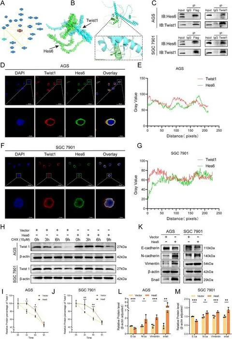 Hes6 binds to Twist1 and maintains the stability of Twist1, promoting epithelial-mesenchymal transition (EMT) of GC cells