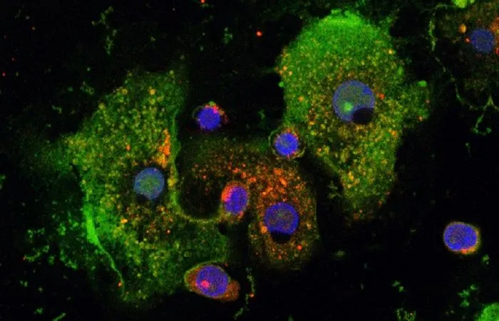 Human macrophages