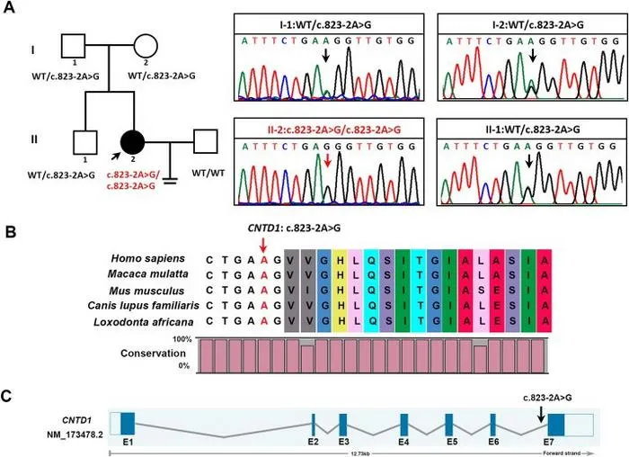 Identification of the pathogenic splicing mutation of CNTD1 from the pedigree of diminished ovarian reserve