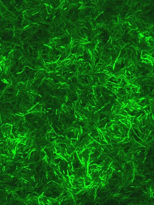 Pseudomonas aeruginosa bacteria labeled with green fluorescent protein