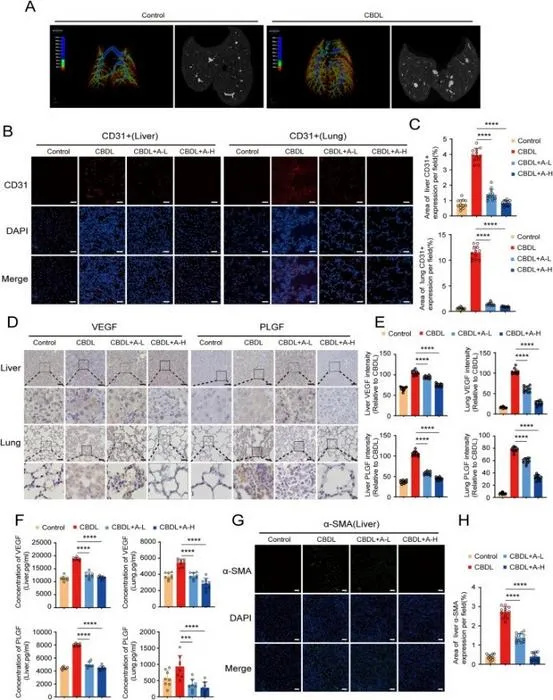 The use of agrimoniin can alleviate hepatic and pulmonary angiogenesis and the fibrosis of liver tissue