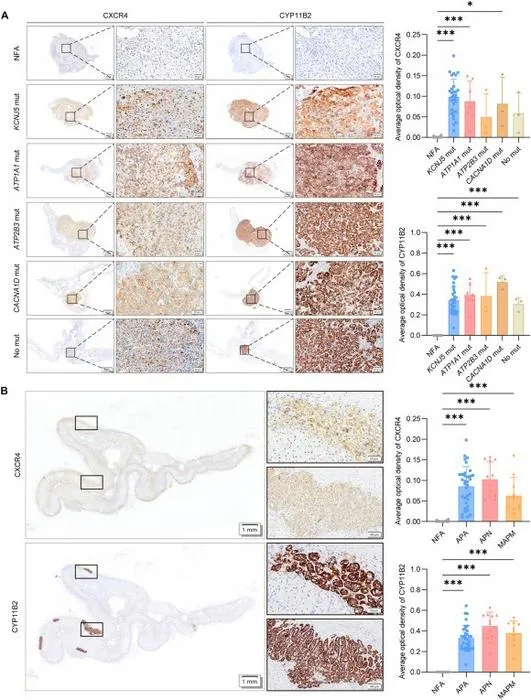 CXCR4 is highly expressed in aldosterone-producing lesions.