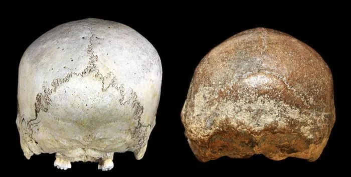 Cranial deformation in historical modern human and H. erectus
