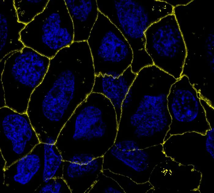 Repaired Gut Epithelium