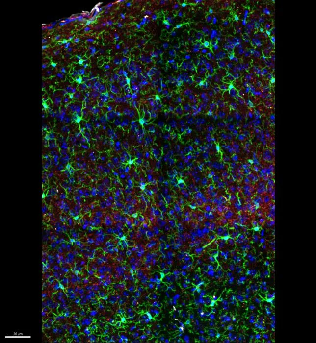 Microglia
