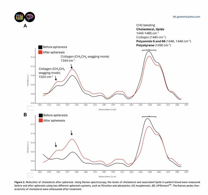 Reduction of cholesterol after apheresis.