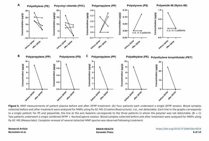 Micro- and nanoplastics (MNPs) measurements of patient plasma before and after double-filtration plasmapheresis (DFPP) treatment