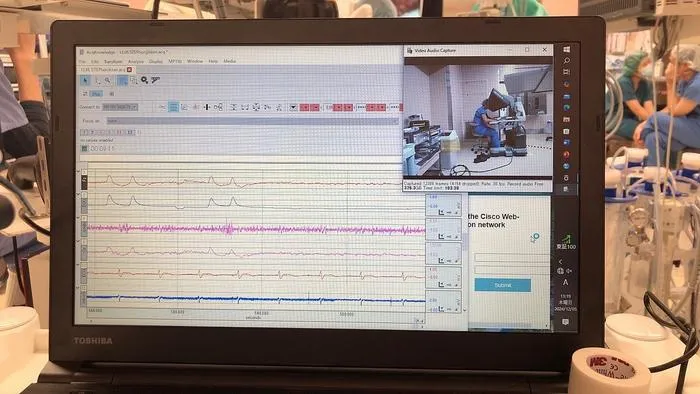 Lining up physiological measurements with video footage from the surgery