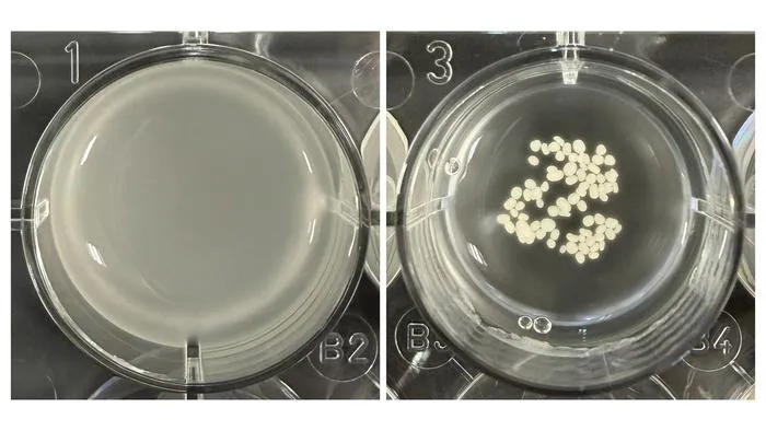 Flocculated yeast