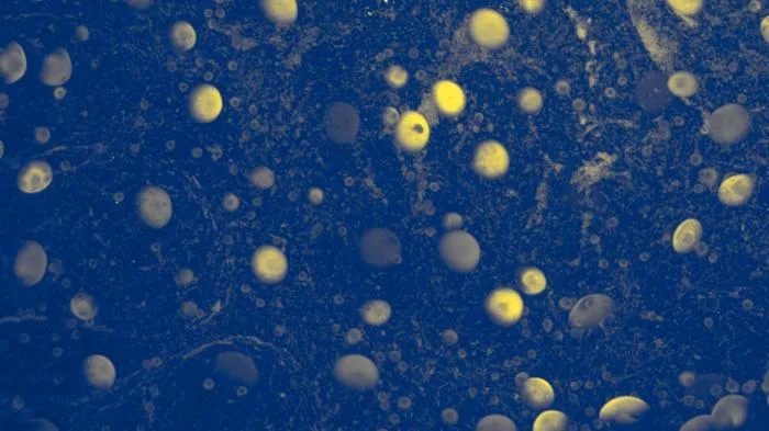 Planets or cells?