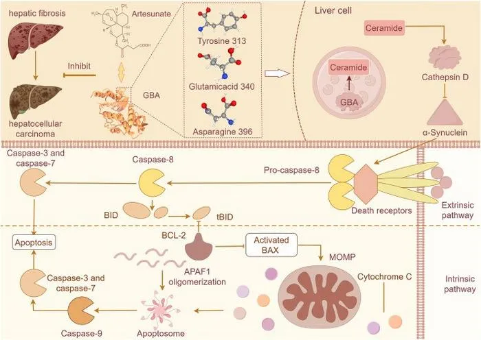 Mechanism diagram depicting that GBA-Ceramide-CTSD-BID-BAX signaling may be the key putative target pathway of artesunate in halting the progression of HCC, and Y313, E340, and N396 may serve as important binding sites of GBA protein with artesunate.