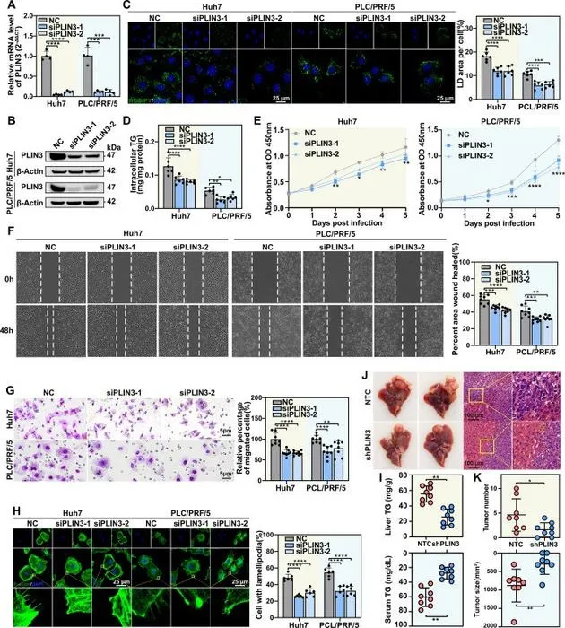 PLIN3 knockdown inhibits hepatocellular carcinoma cell proliferation and migration.