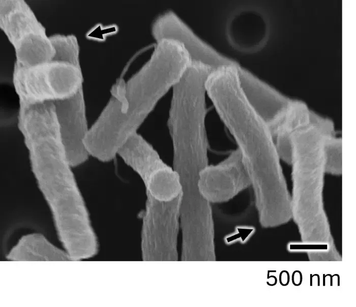 Pole shapes of E. coli