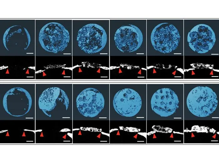 Bone tissue bioprinting body photo