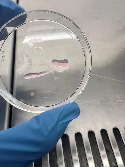 Engineered heart tissues in a petri dish after being removed from the posts