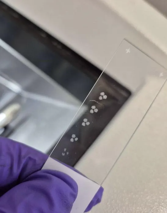 Brain organoids