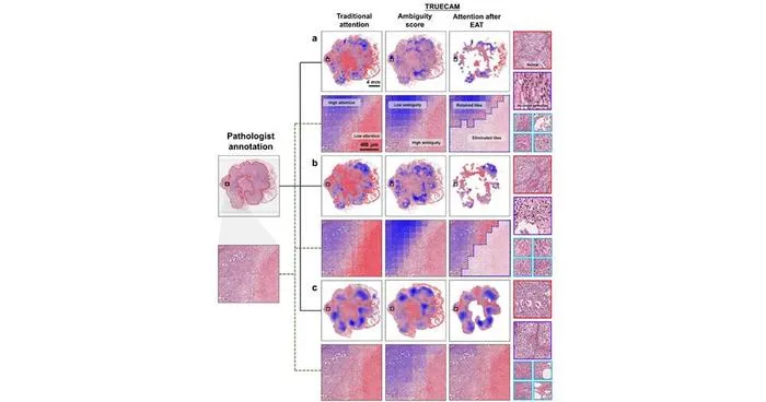 PolyU research team develops trustworthy AI framework TRUECAM to enhance reliability of pathology AI in cancer diagnosis