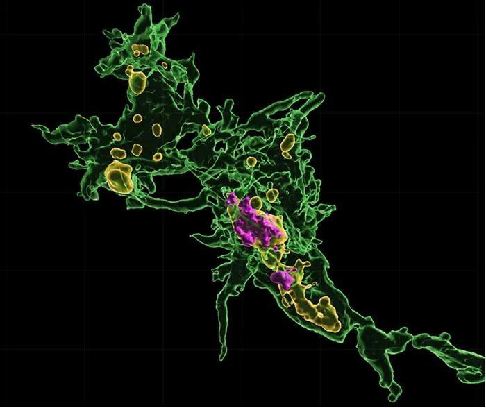Microglia after eating motor neurons