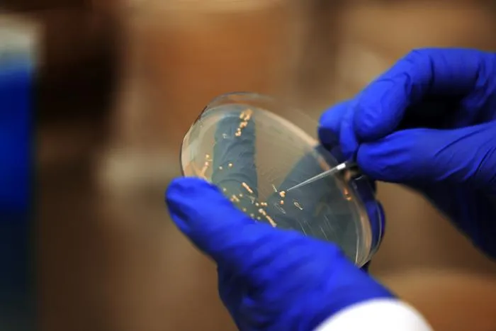 Yeast‑derived universal flu vaccine could someday replace yearly injections